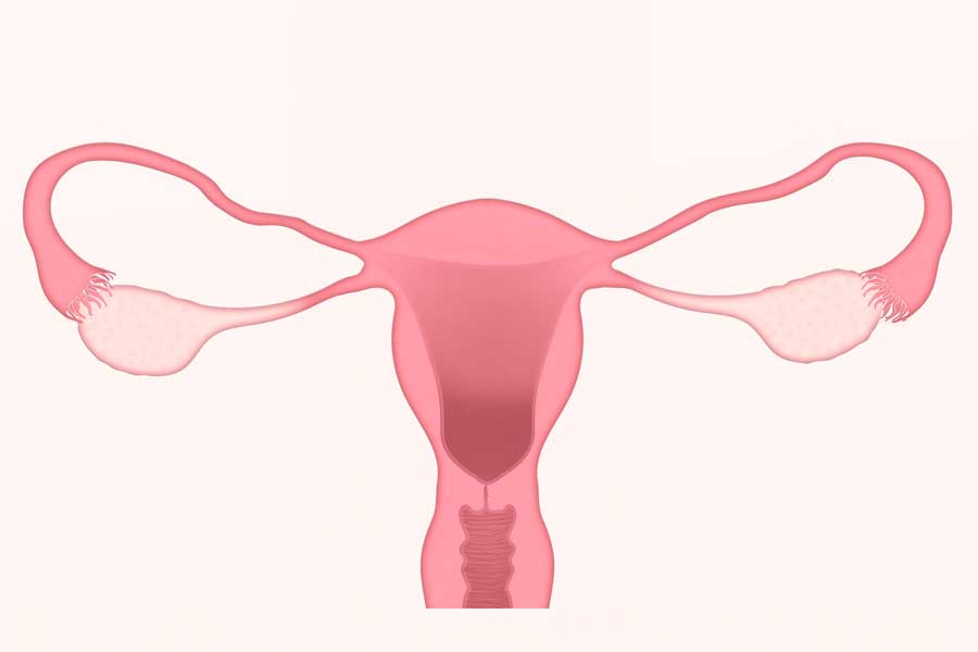 ¿Qué es una biopsia endometrial? FIVCenter ¿Qué es una biopsia endometrial? FIVCenter